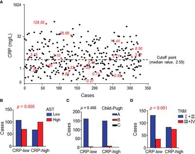 C-Reactive Protein Is an Indicator of the Immunosuppressive Microenvironment Fostered by Myeloid Cells in Hepatocellular Carcinoma